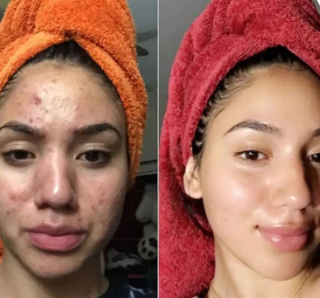 Dr. Melaxin Peel Shot™